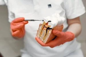 Los mejores consejos para el cuidado despues de una extraccion dental