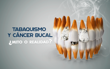 CANCER ORAL PRODUCIDO POR EL TABAQUISMO