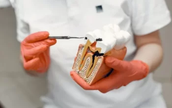 Los mejores consejos para el cuidado despues de una extraccion dental